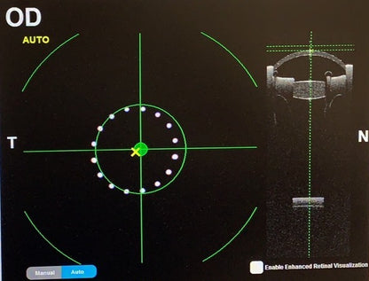 Model Eye - Toric Cornea